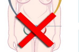 Santé | La ménopause ou la sécheresse intime des femmes