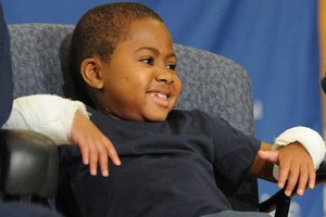 USA: première greffe des deux mains chez un enfant