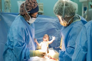 Des gynécologues s'alarment de l'explosion du nombre de césariennes dans le monde