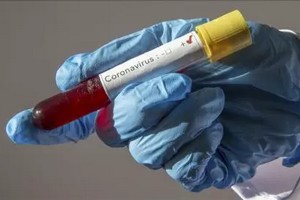 Répartition des contaminés au Covid entre les hôpitaux mauritaniens