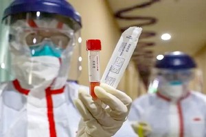 Coronavirus : bientôt 100 000 cas dans le monde, 423 en France, l’épidémie « inexorable »