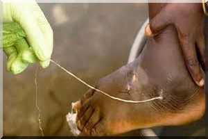 Ministère de la Santé : Communiqué de presse