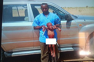 La malnutrition frappe les enfants dans les deux Hodhs et le CSA reste absent