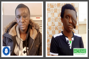 L’opération chirurgicale de Cheikhou SAKHO menée avec succès !